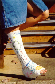 #24-517 Leila - plaster short leg walking cast 