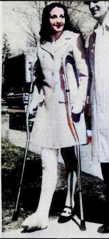 Not sure how this young lady broke her leg but she is getting around on Unistrut crutches
