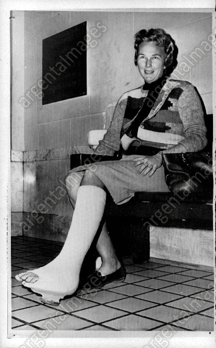 Mickey Wright with classic plaster walking cast and rubber walking heel