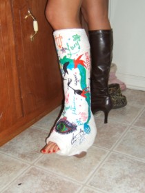 #28-494 Lisa - plaster short leg walking cast