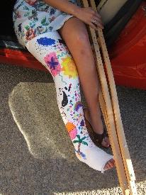#30-3202R Roxie - plaster long leg cast 
