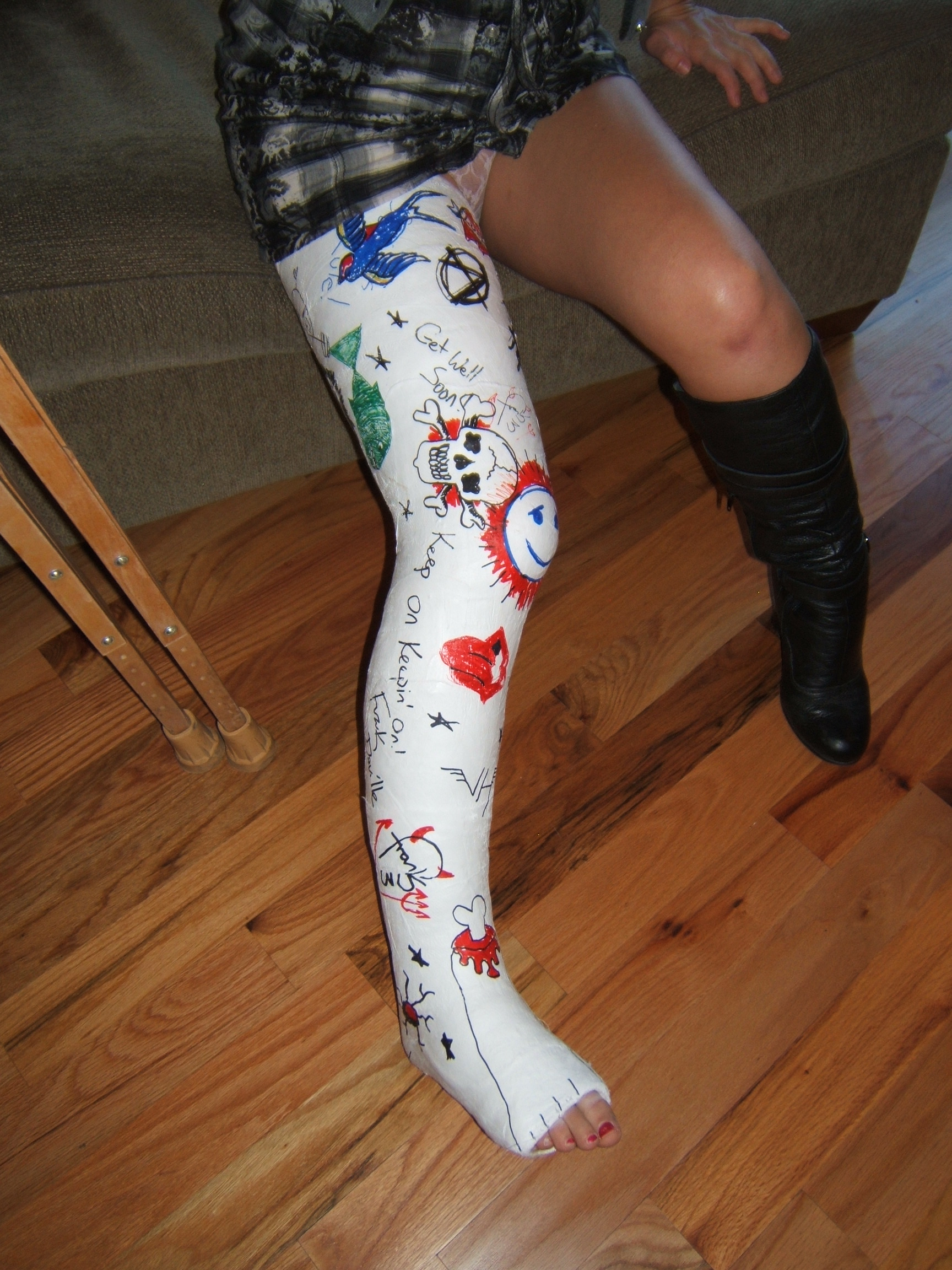 #32-0713 Cherie DeVille - plaster long leg cast